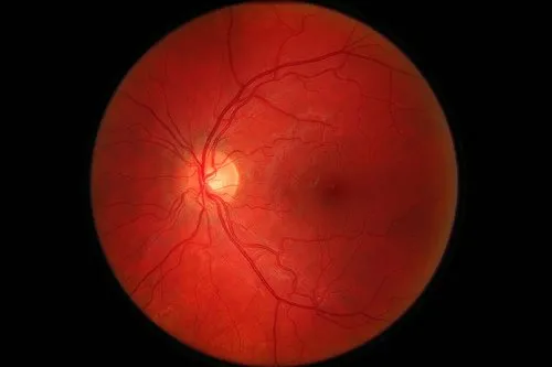 Photo of my retina